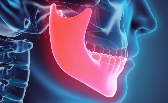 Illustrated side profile x ray of face with jawbone highlighted red