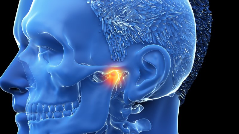 Digital illustration of a TMJ